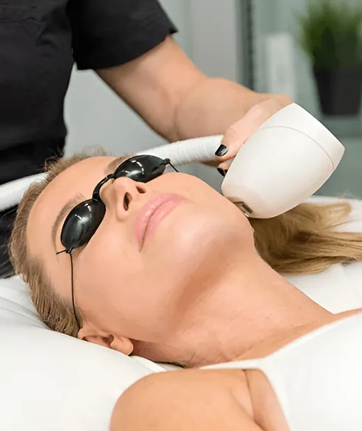 Acne IPL light treatment at Valley Aesthetic