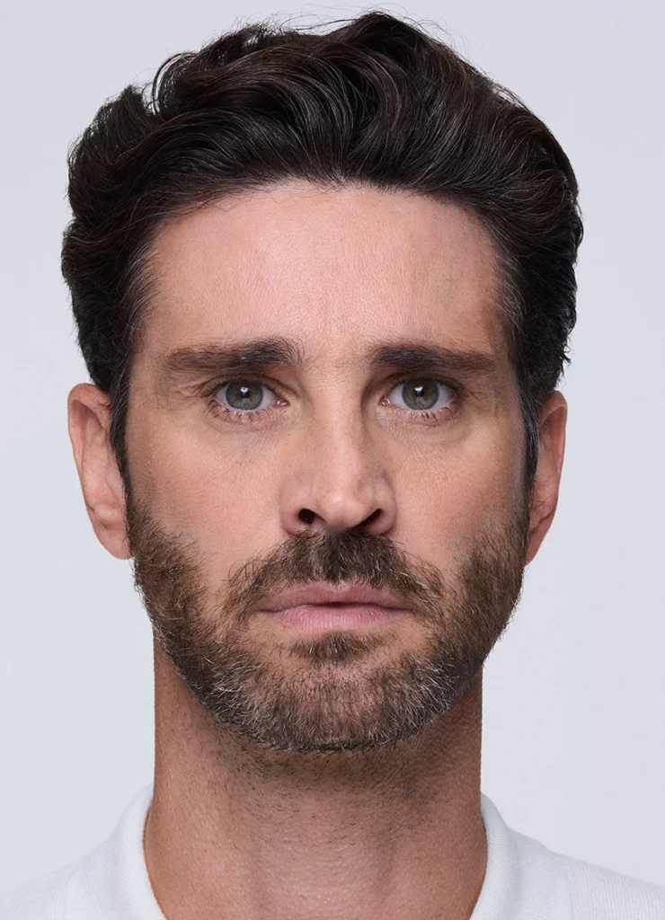 After XEOMIN frown lines treatment