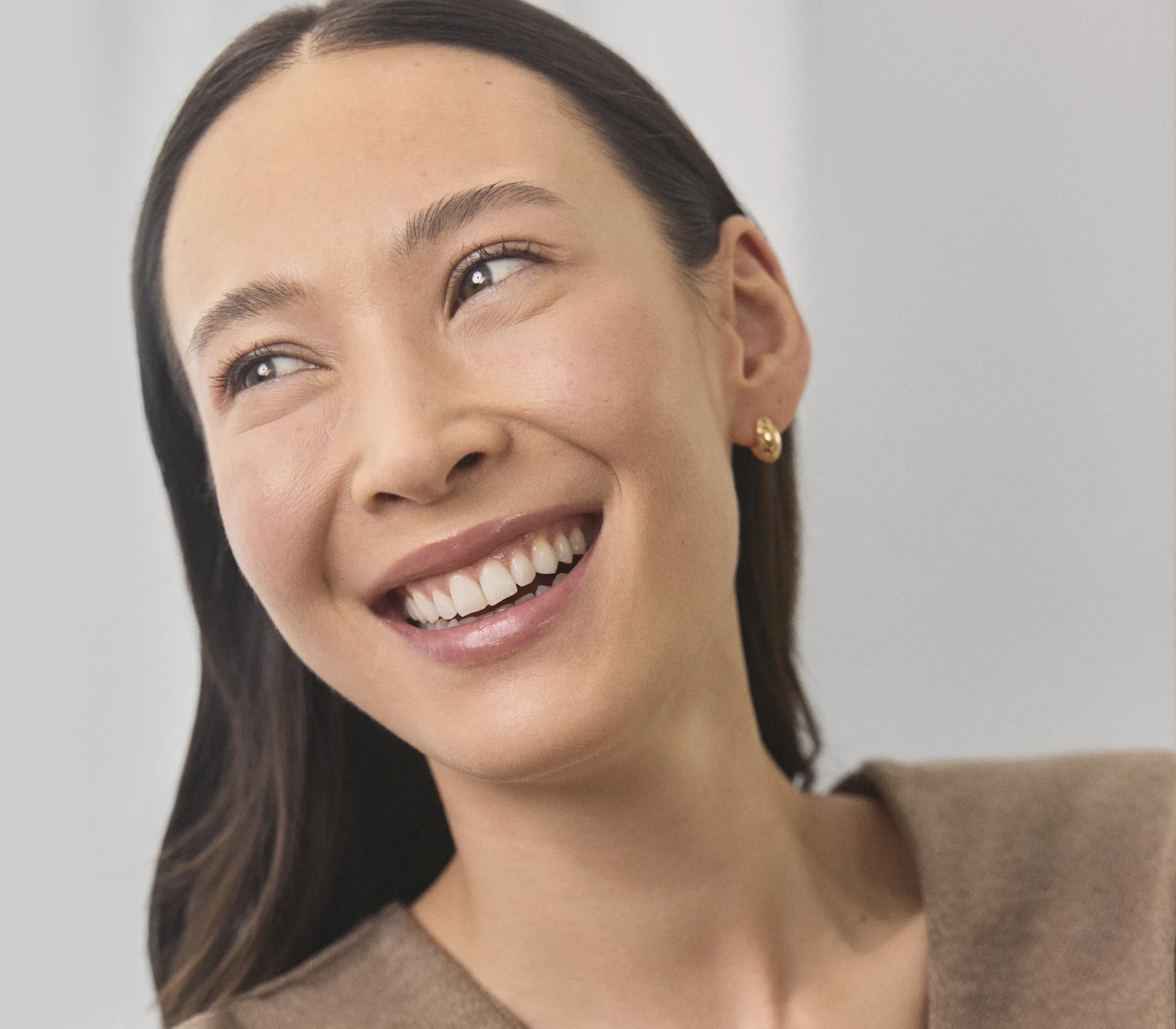 XEOMIN neurotoxin results — patient at Valley Aesthetic